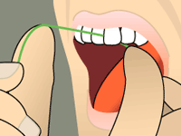 Curving floss into a C-shape against one tooth