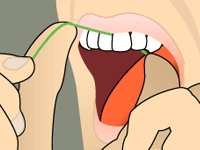 Sliding floss up and down along each tooth